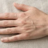 Use the back of the hand sample photo